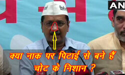 Arvind Kejriwal, Aam Aadmi Party, MLA, AAP MLA, Kejriwal Pitai, Delhi CM, अरविंद केजरीवाल, आम आदमी पार्टी, आप विधायक, AAP विधायक, केजरीवाल पिटाई, दिल्ली मुख्यमंत्री Arvind Kejriwal, Aam Aadmi Party, MLA, AAP MLA, Kejriwal Pitai, Delhi CM, अरविंद केजरीवाल, आम आदमी पार्टी, आप विधायक, AAP विधायक, केजरीवाल पिटाई, दिल्ली मुख्यमंत्री